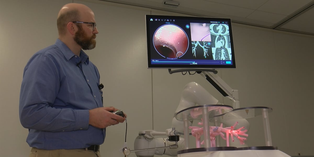 New robot technology at Essentia Health is changing lung cancer detection in the Northland New robot technology at Essentia Health is changing lung cancer detection in the Northland